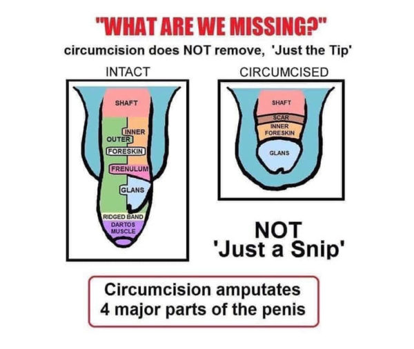 Male Circumcision The Unkindest Cut Masscentral Media